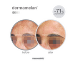 Mesoestetic Dermamelan Treatment Cream Pigment Control Solutions 30 g / 1.06 oz