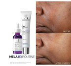 La Roche-Posay Mela B3 Melasyl + Niacinamide Anti Aging and Dark Spot Corrector Serum for Face, 1.0 fl oz